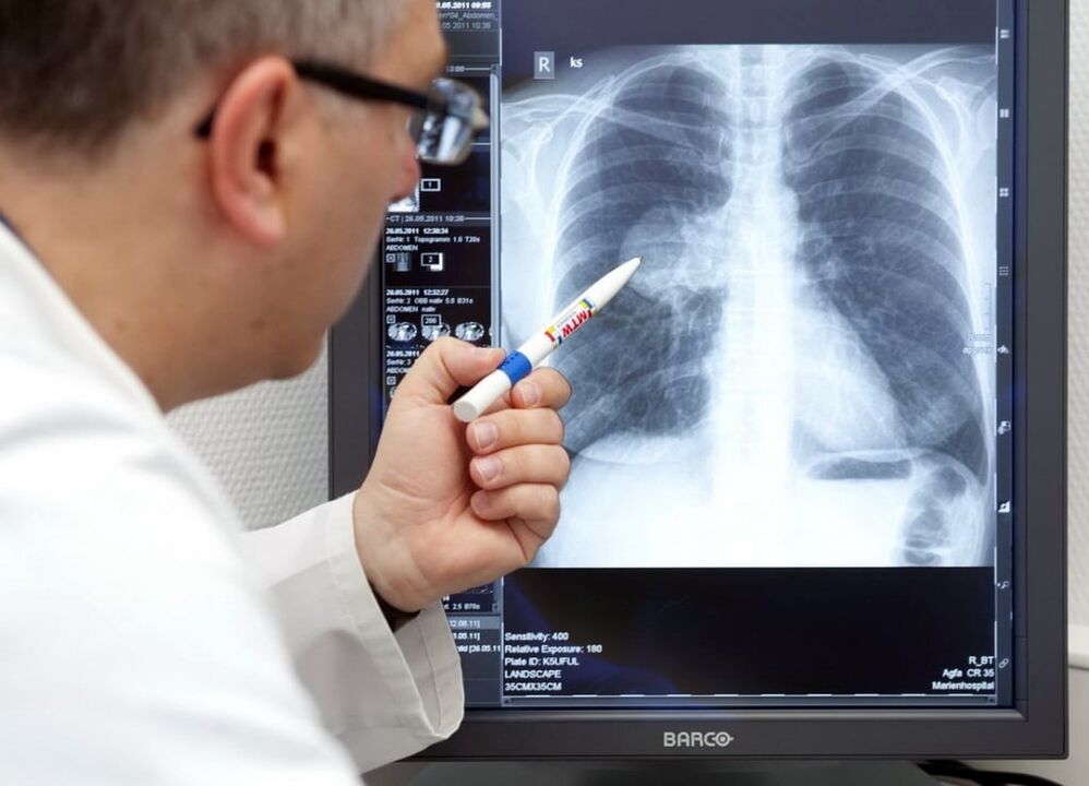diagnostika arteriálnej hypertenzie